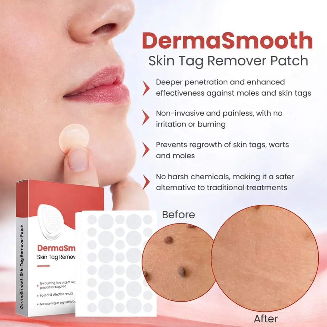DermaSmooth Skin Tag Remover Patch Fast Safe Painless Skin Tag Mole Removal Nano Microneedle Technology 72 Patches 1